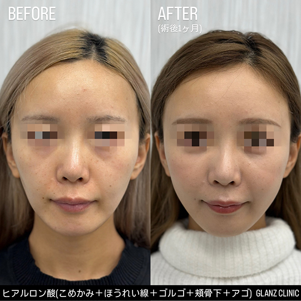 症例写真