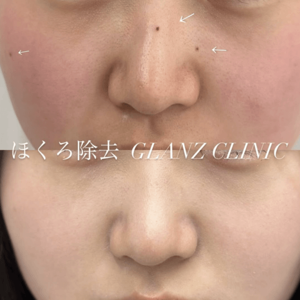 症例写真-02
