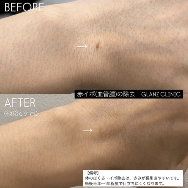症例写真-07
