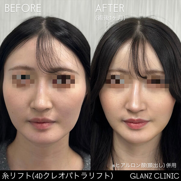 症例写真-03