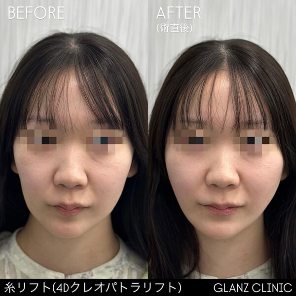 症例写真-05