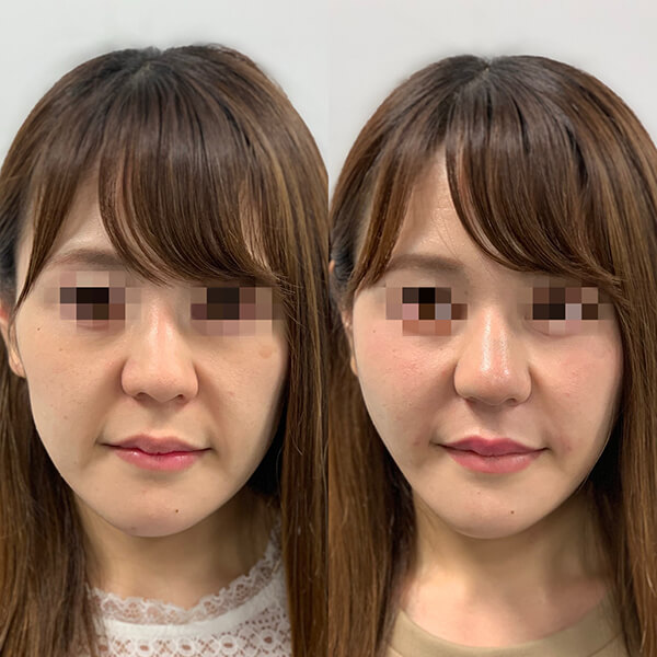 症例写真-07