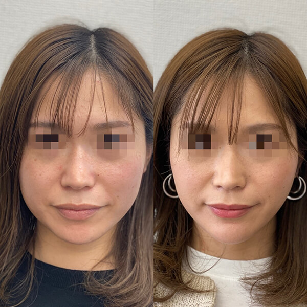 症例写真-08