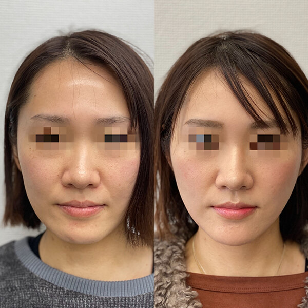 症例写真-09