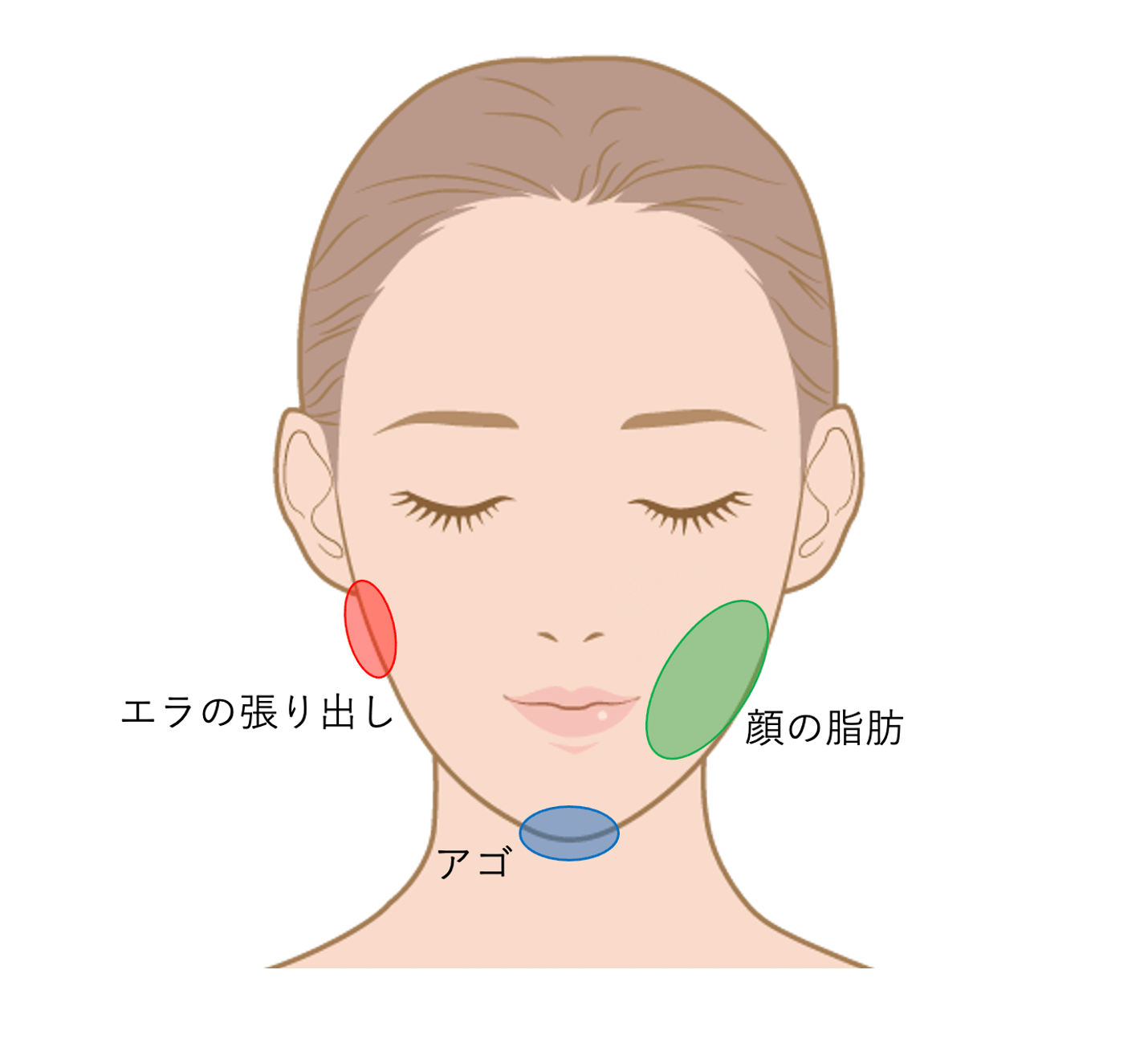 輪郭治療 一覧