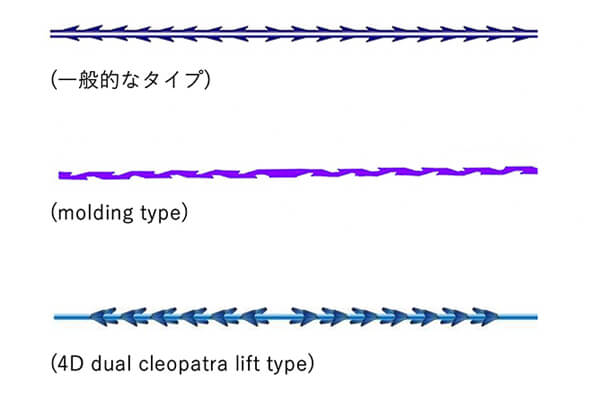 当院で取り扱っている糸リフト